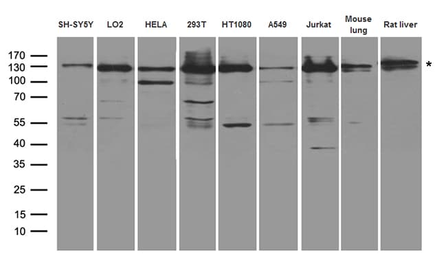 Polyclonal Rabbit anti-Human XPC Antibody (WB)