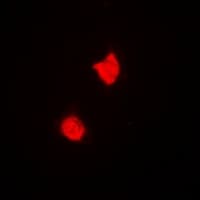 TREX1 Antibody