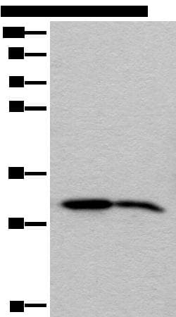 Polyclonal Rabbit anti-Human IMPA1 / IMP Antibody (WB)
