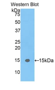 E-FABP / FABP5 Antibody (aa2-135)