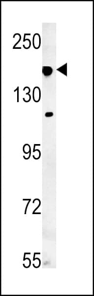 IFT172 Antibody (aa28-57)