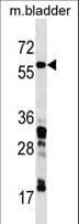 Polyclonal Rabbit anti-Human CORO1C Antibody (aa377-403, WB)