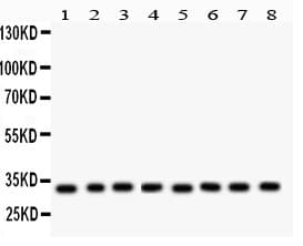 SMN1 Antibody (aa22-52)