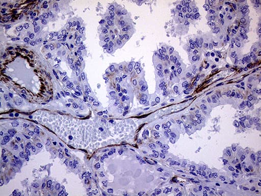 MLPH / Melanophilin Antibody (aa295-600, clone OTI6E3)