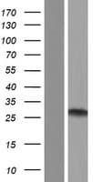 RIPPLY3 / DSCR6 Protein (Over-Expression Lysate Myc-DDK (Flag))