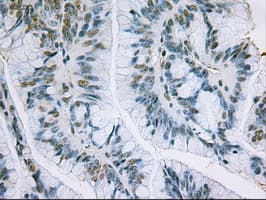 Monoclonal Mouse anti-Human EPCAM Antibody (clone OTI2C8, IHC, WB)