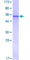 Human AKR1E2 Protein (Recombinant GST)