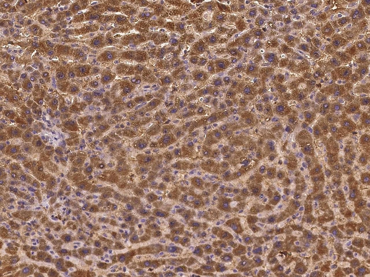 GALNT18 / GALNTL4 Antibody