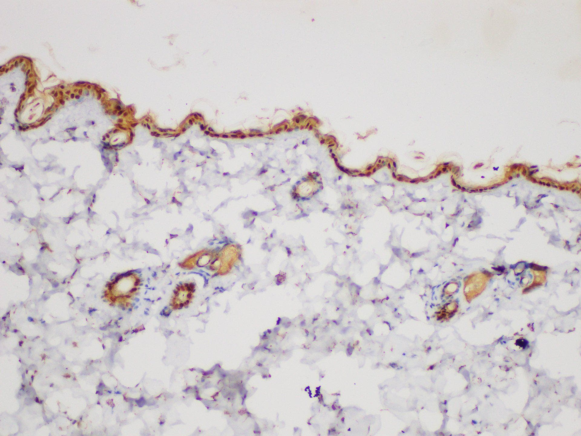 SERPINB2 / PAI-2 Antibody