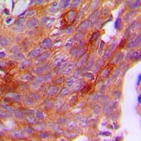 IHC-plus™ CGB / hCG Beta Antibody (C-Terminus)