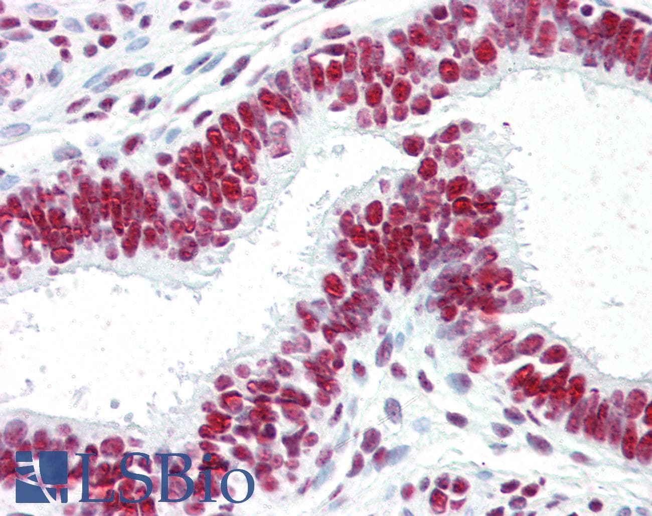 PathPlus™ ACIN1 / Acinus Antibody