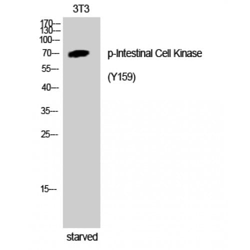ICK Antibody (phospho-Tyr159)