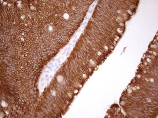KRT18 / CK18 / Cytokeratin 18 Antibody (aa69-372, clone OTI2H10)