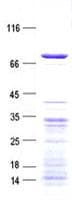 Human SSX2IP Protein (Recombinant His, N-Terminal)