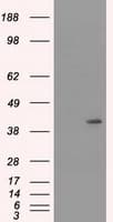 PathPlus™ Monoclonal Mouse anti-Human KRT19 / CK19 / Cytokeratin 19 Antibody (clone 3F8, IHC, IF, WB)