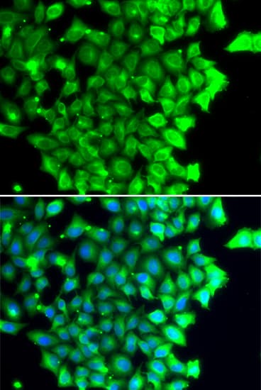 IHC-plus™ Polyclonal Rabbit anti-Human TRIAP1 Antibody (IHC, IF, WB)