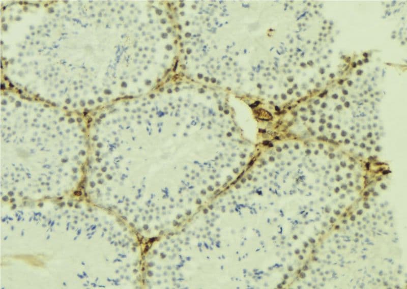 Polyclonal Rabbit anti-Human QIP1 / KPNA4 Antibody (IHC, IF, WB)