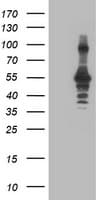 CCM2 / Malcavernin Antibody (clone OTI1D1)