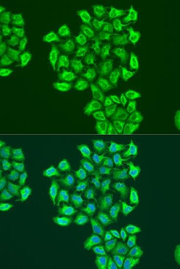NIP3 / BNIP3 Antibody