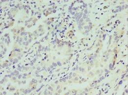 Polyclonal Rabbit anti-Human ATF7 Antibody (aa1-117, IHC, WB)