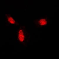 SUMO1 / SMT3 Antibody (N-Terminus)