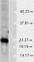 SOD1 / Cu-Zn SOD Antibody (PerCP)