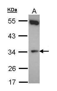 Polyclonal Rabbit anti-Human CYB5R1 Antibody (aa1-275, WB)