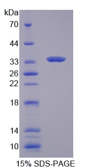 Human TYK2 Protein (Recombinant His-T7)
