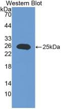 IL17RE Antibody (aa457-630)
