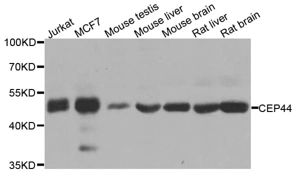 CEP44 / KIAA1712 Antibody
