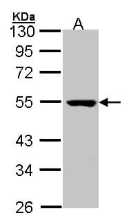 PSKH1 Antibody (aa1-218)