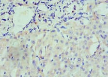 NRP1 / Neuropilin 1 Antibody (aa684-923)