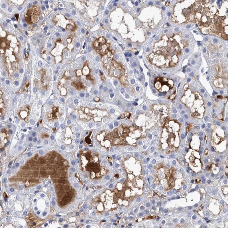 IHC-plus™ Complement C2 Antibody (clone 5C3)