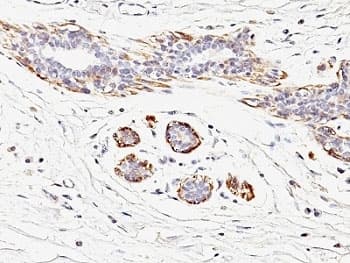 SMMHC / MYH11 Antibody (clone MYH11/923)