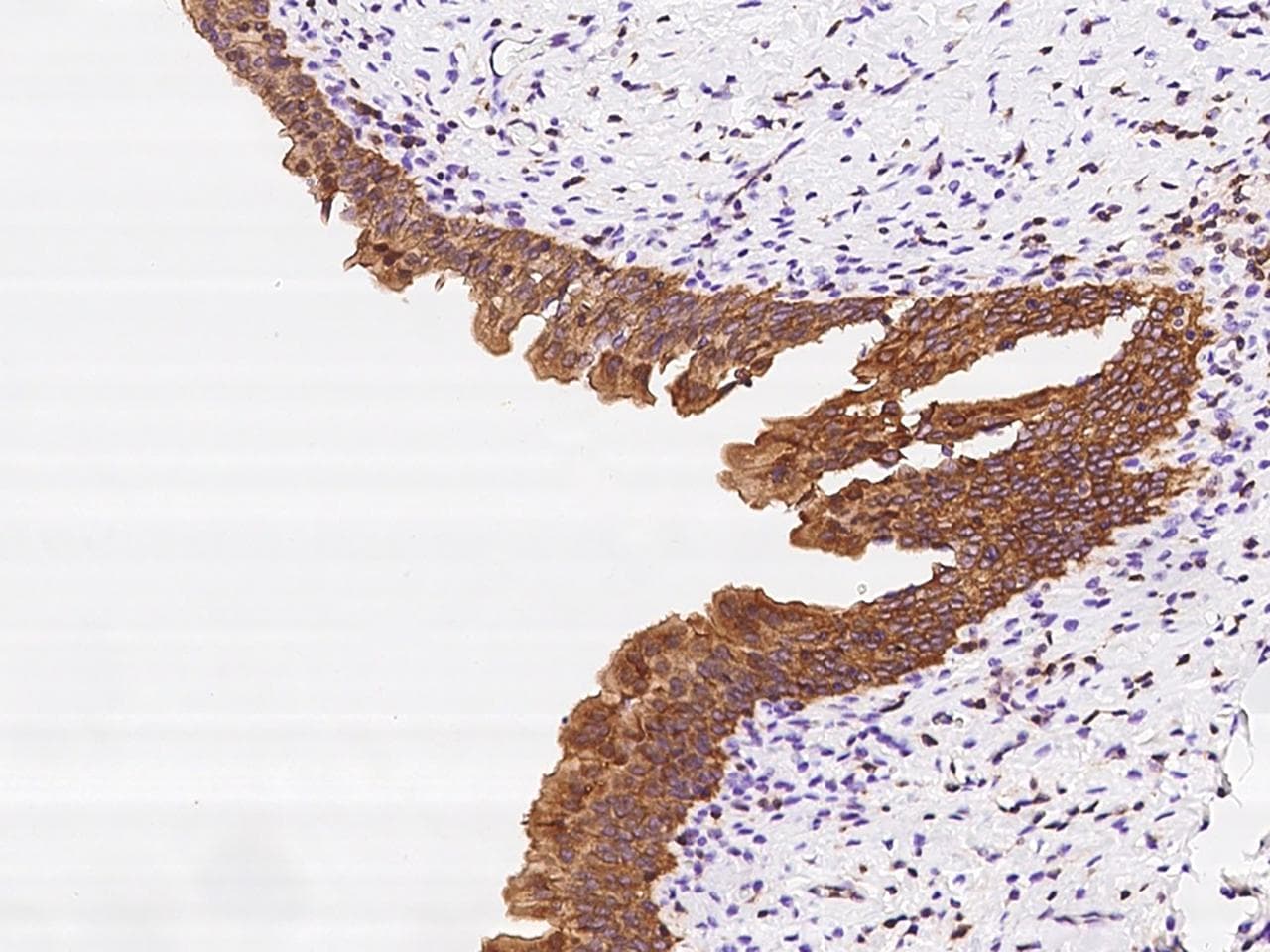 Polyclonal Rabbit anti-Human DENND2D Antibody (IHC)