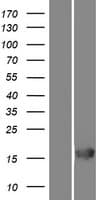 Human RGS21 Protein (Over-Expression Lysate Myc-DDK (Flag))