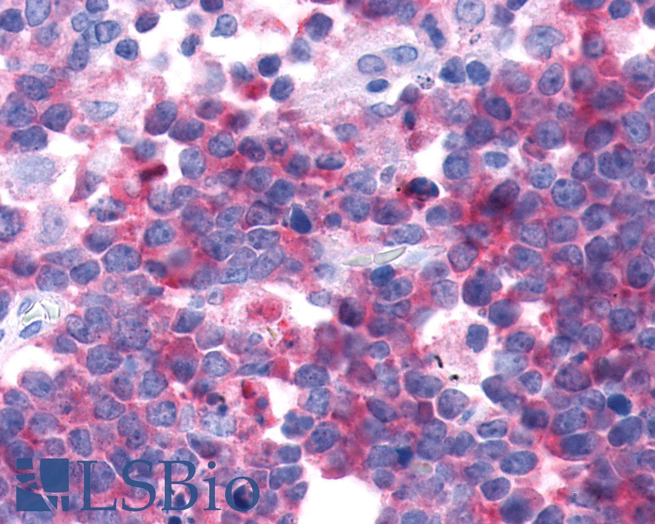 PathPlus™ GPR44 / CRTH2 Antibody (N-Terminus)