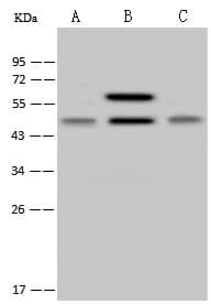 NDUFS2 Antibody