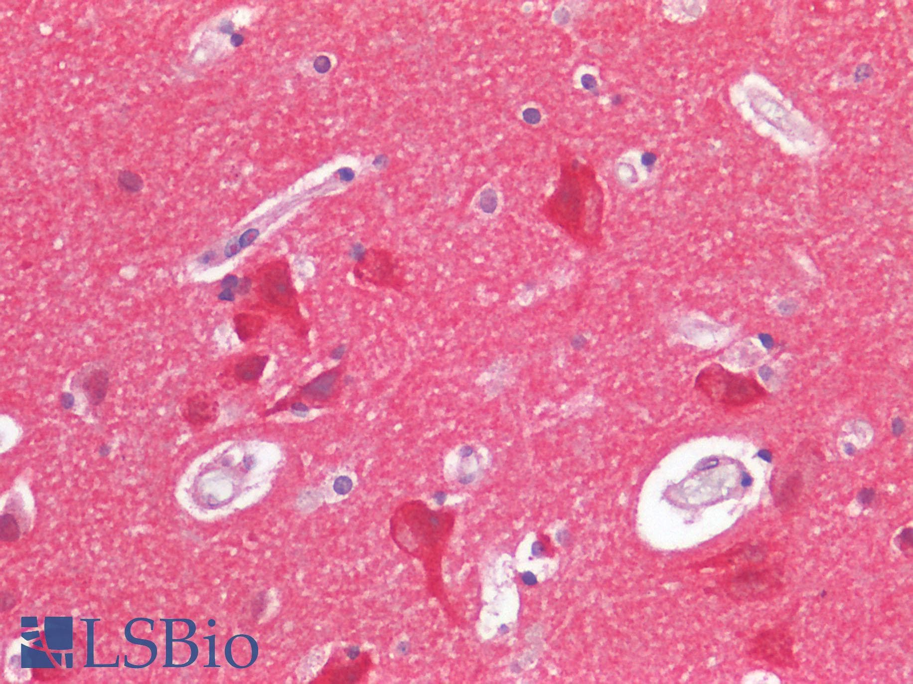 IHC-plus™ FURIN Antibody
