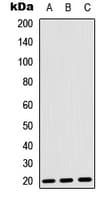 FGF22 Antibody (Internal)