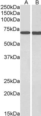 IHC-plus™ Polyclonal Goat anti-Human MTM1 / Myotubularin Antibody (aa590-603, IHC, WB)