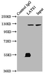 Polyclonal Rabbit anti-Human LATS1 Antibody (IHC, IF)