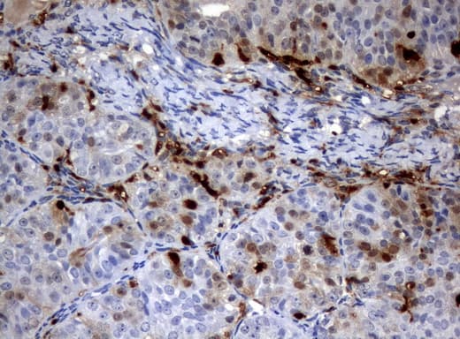 Monoclonal Mouse anti-Human TP / Thymidine Phosphorylase Antibody (clone UMAB90, aa311-482, IHC, WB)