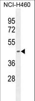 Polyclonal Rabbit anti-Human PDHA2 / PDH E1 Beta Antibody (aa287-314, IHC, WB)
