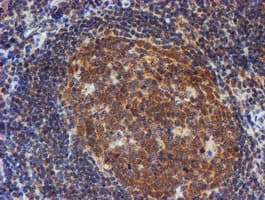 TIP48 / RUVBL2 Antibody (clone OTI1D9)