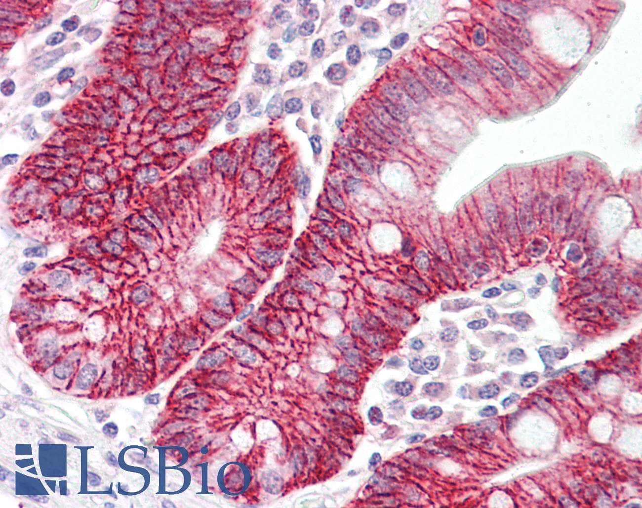 IHC-plus™ CLDN7 / Claudin 7 Antibody (aa162-211)