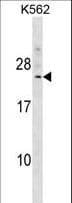 DCAKD Antibody (aa51-80)