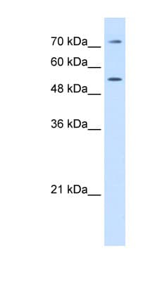 LBP Antibody (aa401-450)