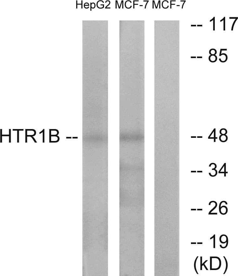 HTR1B / 5-HT1B Receptor Antibody (aa261-310)