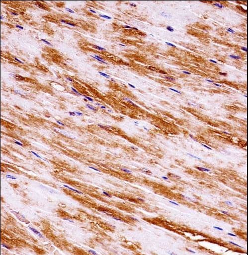 MAP3K1 / MEKK1 Antibody (aa1194-1221)